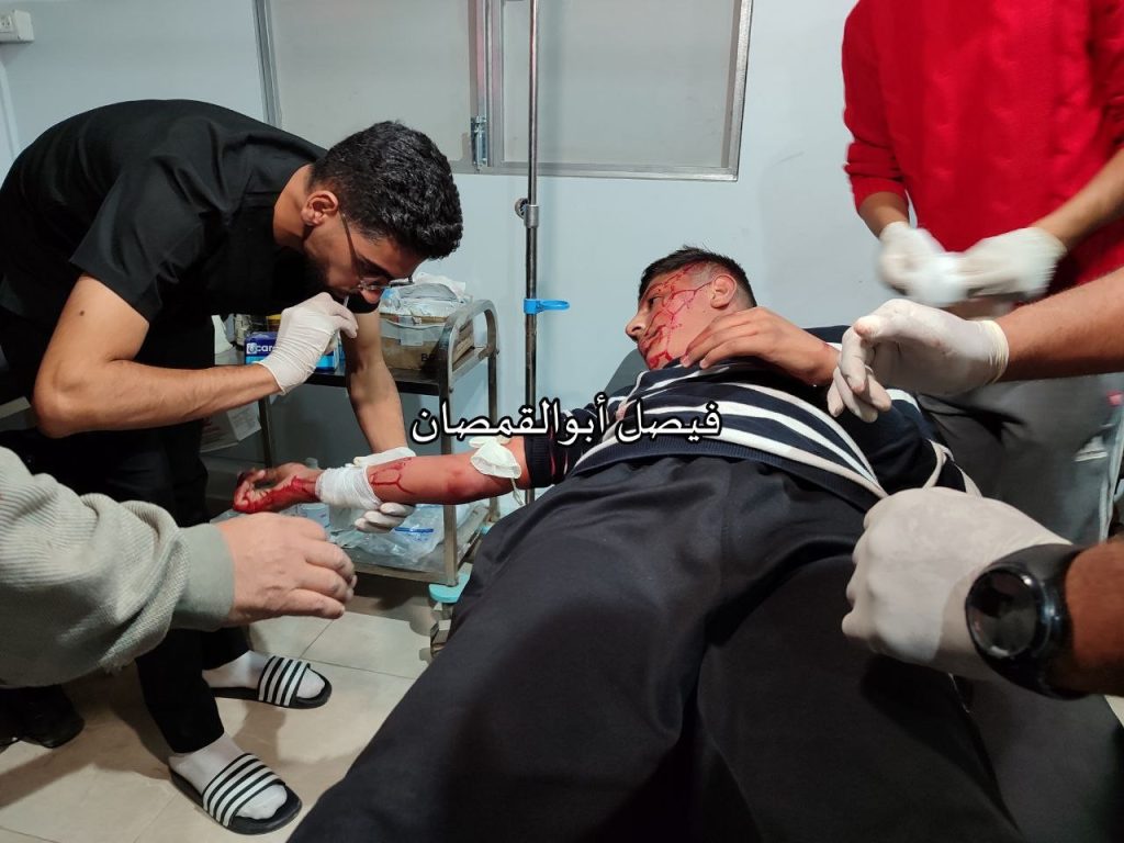 5 شهداء ومصابون في قصف الاحتلال خيمة تؤوي نازحين في مخيم البريج