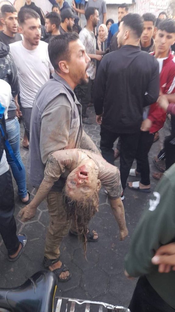 الاحتلال يرتكب مجزرة جديدة: عشرات الشهداء والجرحى في قصف مدرسة تؤوي نازحين شرق البريج