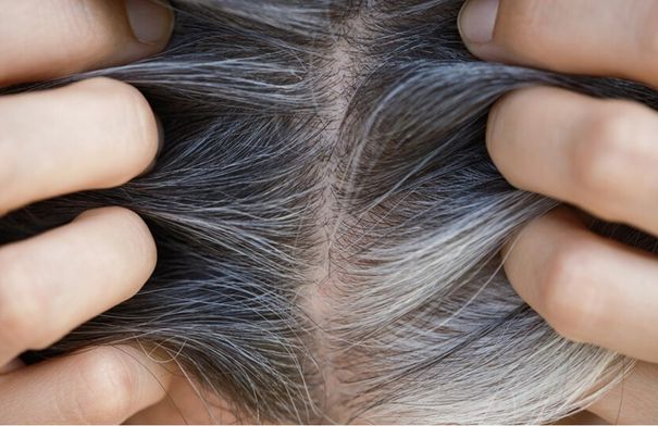 عادة سيئة تتسبب في تساقط الشعر وظهور الشيب مبكرا…