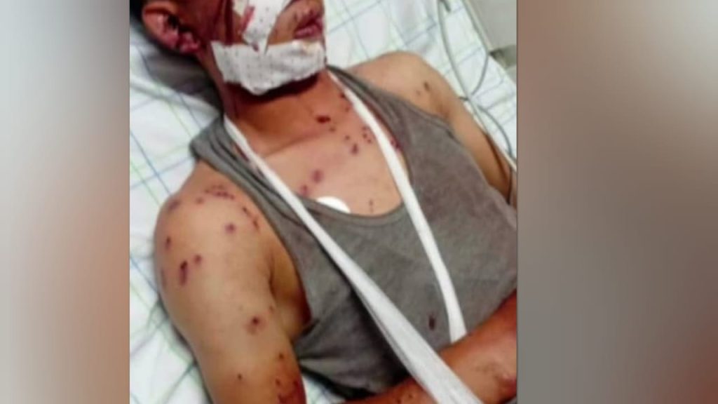 تلقى رصاصة طائشة .. إصابة شاب في رحلة صيد نواحي تنغير