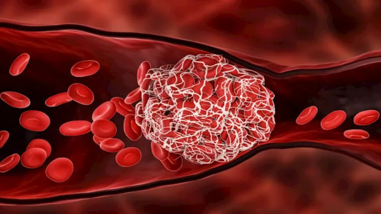 كيف يساعد الليمون في مكافحة الالتهابات وتعزيز صحة القلب؟