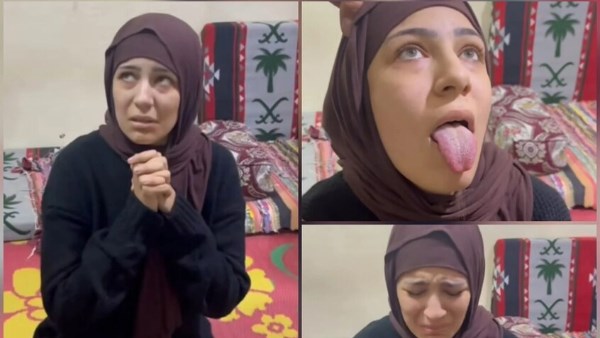 يوم فرحها.. فتاة البشعة تروي قصة تعامل الجيران معها قبل وبعد البشعة