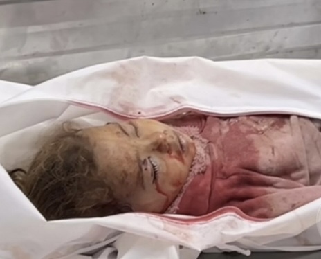 اخترقت الخط الاصفر حسب مزاعم الاحتلال..طفلة شهيدة واصابات في تجدد الغارات على قطاع غزة